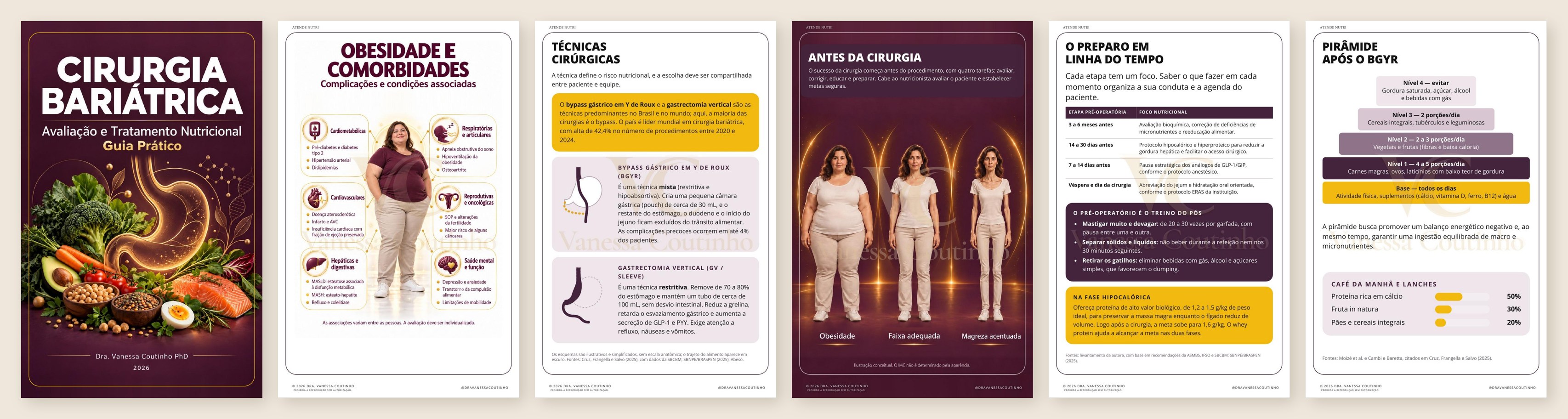 Seis páginas do ebook Atualização em Cirurgia Bariátrica
